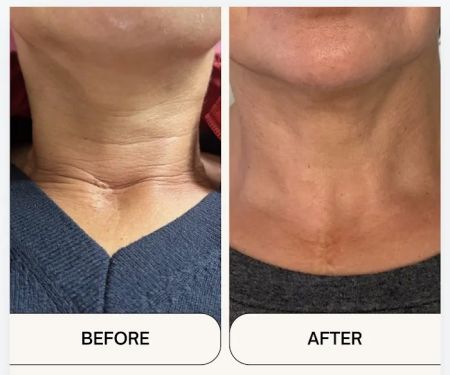 Advanced Skin Lab