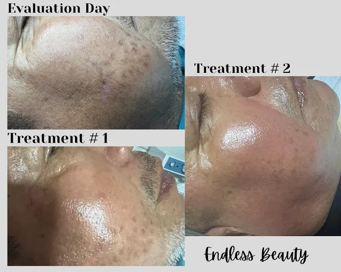 Endless Beauty Picture 5