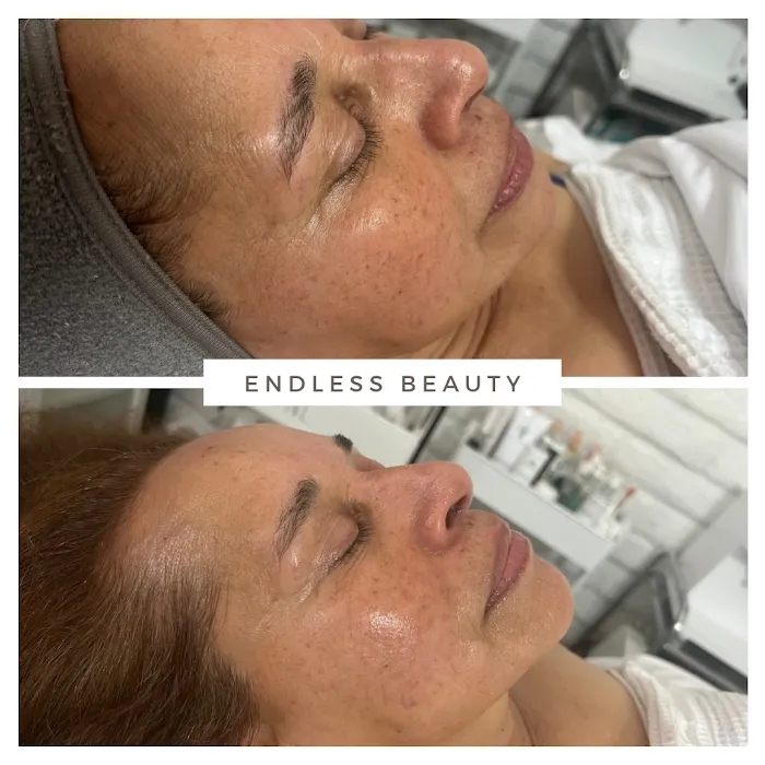 Endless Beauty Picture 6