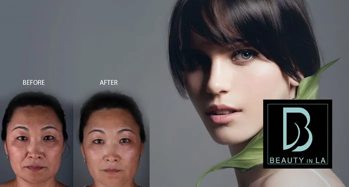 Beauty in LA Cosmetology Clinic. Medical SPA Los Angeles Picture 4