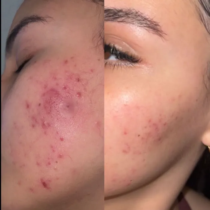 Skin Bar LA Picture 4