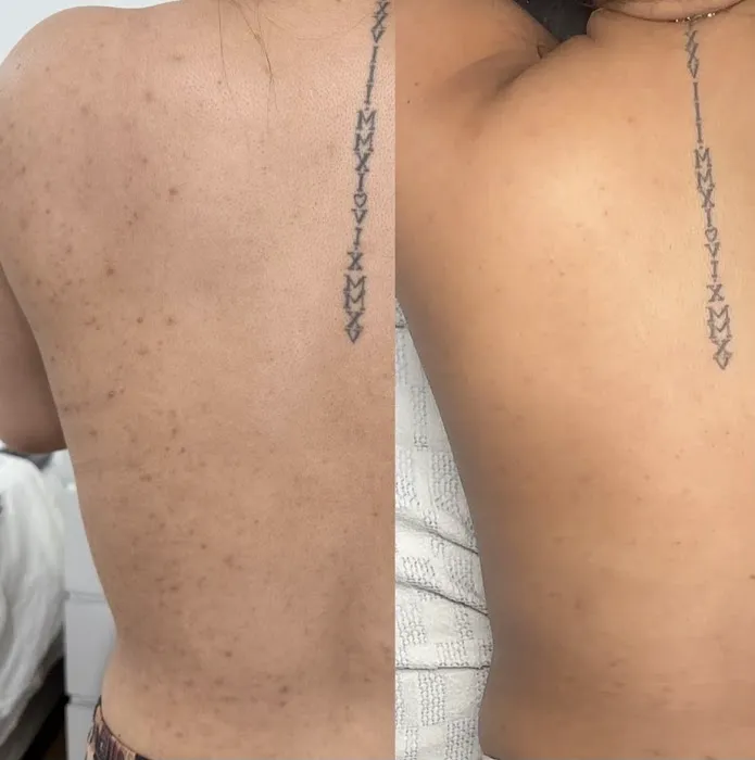 Skin Bar LA Picture 2