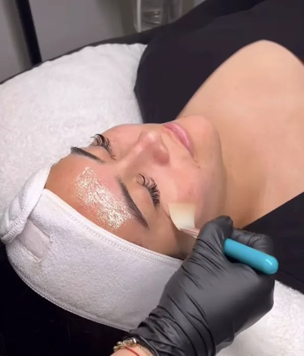 Skin Bar LA Picture 1