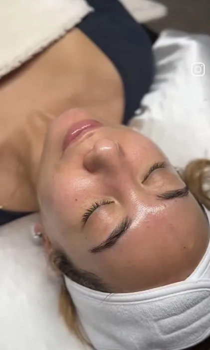 Skin Bar LA Picture 3