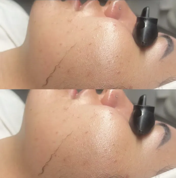 Skin Bar LA Picture 6