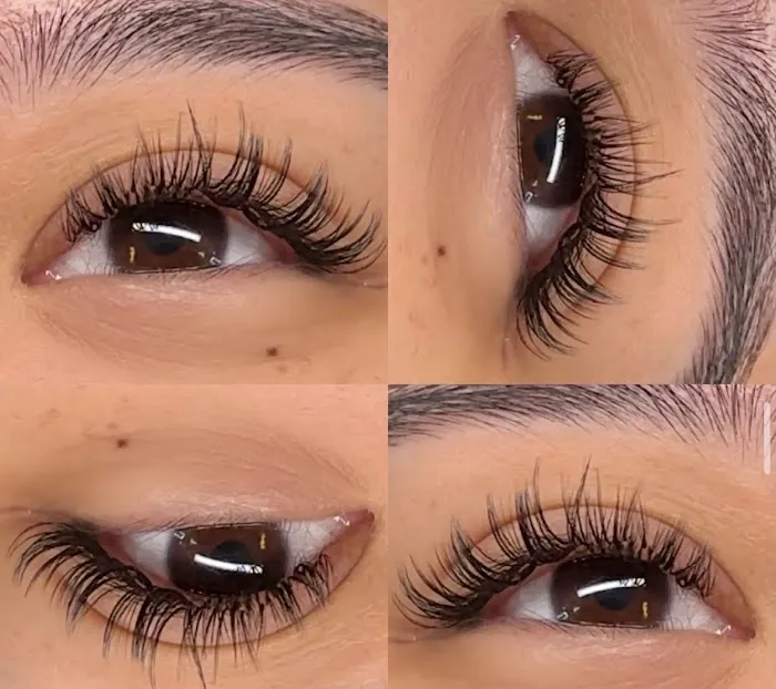 Skin Bar LA Picture 10