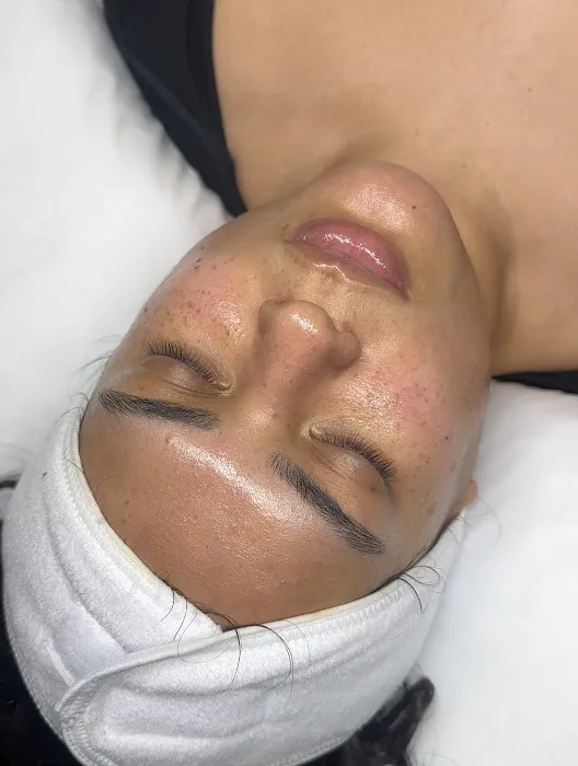 Skin Bar LA Picture 9