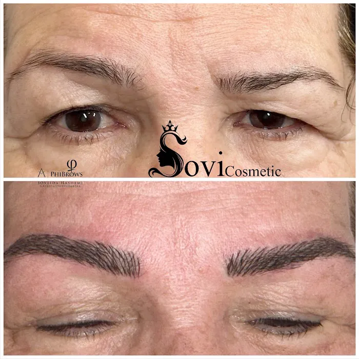 SOVI Cosmetic Picture 2