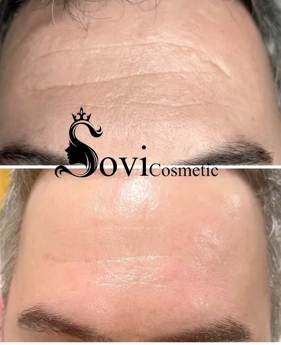 SOVI Cosmetic Picture 4