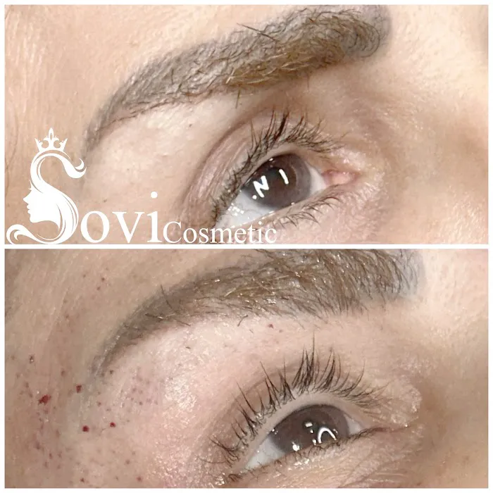 SOVI Cosmetic Picture 3