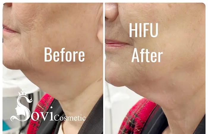 SOVI Cosmetic Picture 8