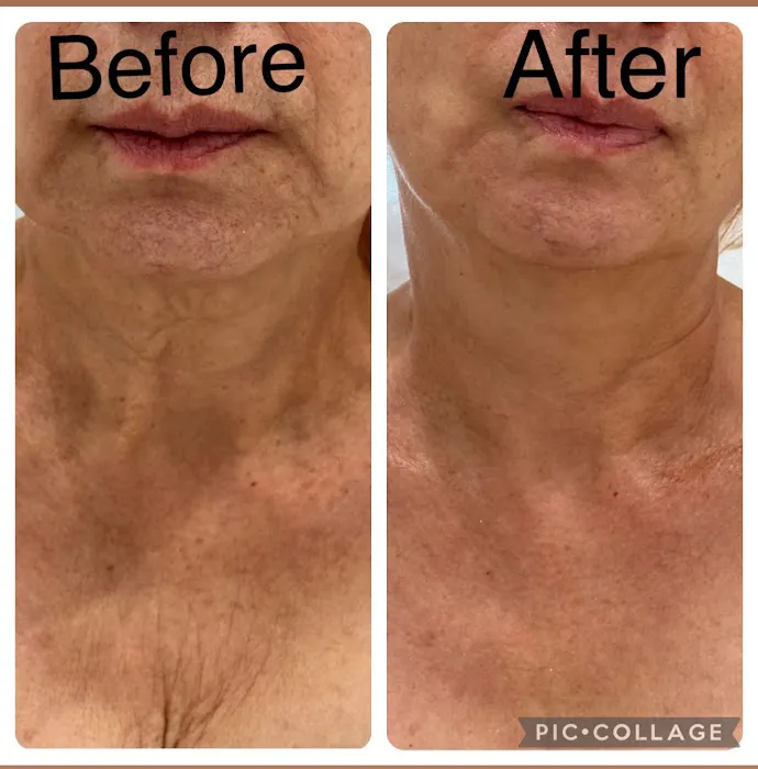 Hasmig Beauty - Licensed Esthetician & Makeup Artist Picture 2