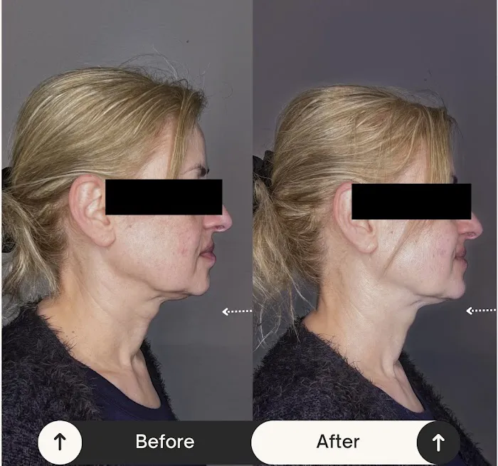 Hasmig Beauty - Licensed Esthetician & Makeup Artist Picture 4