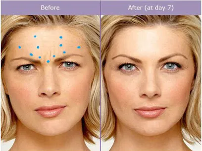 NewSkin Laser Center Picture 5