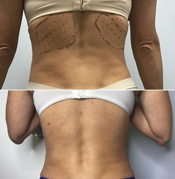 NewSkin Laser Center Picture 6