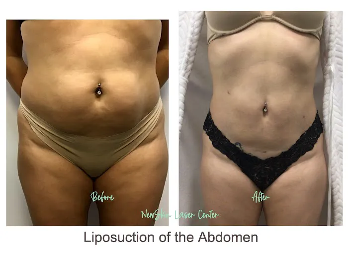 NewSkin Laser Center Picture 3