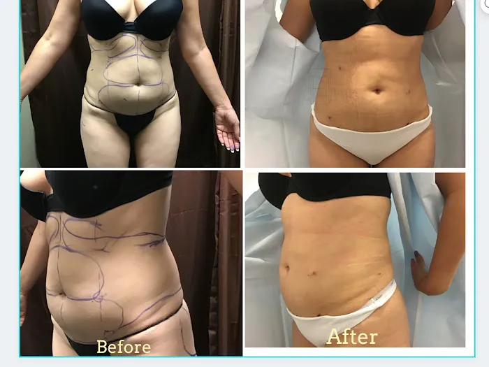 NewSkin Laser Center Picture 10