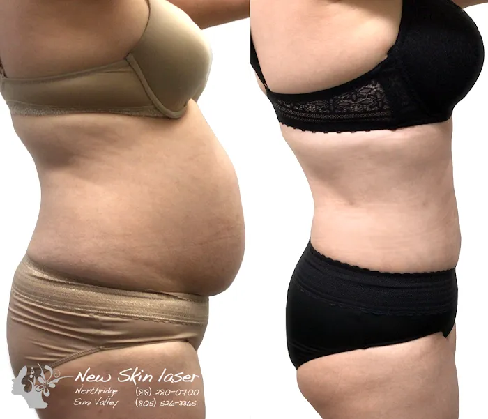 NewSkin Laser Center Picture 9