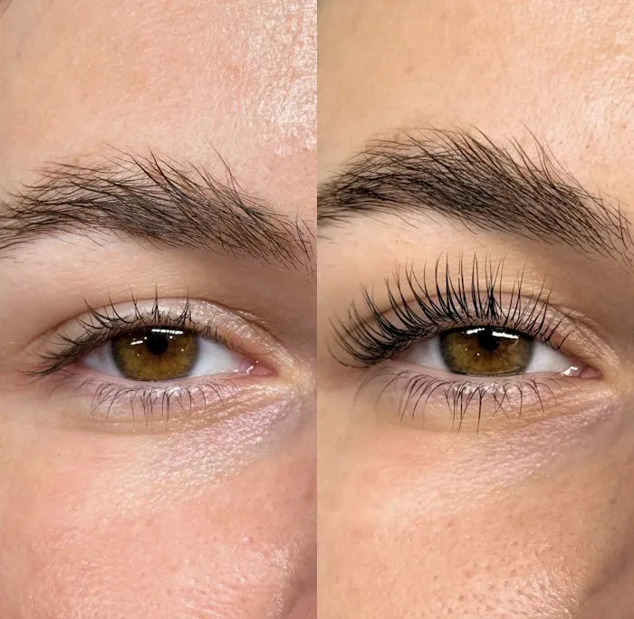 Skin Clinic, LLC By Yasmin Tork Aesthetics Picture 5