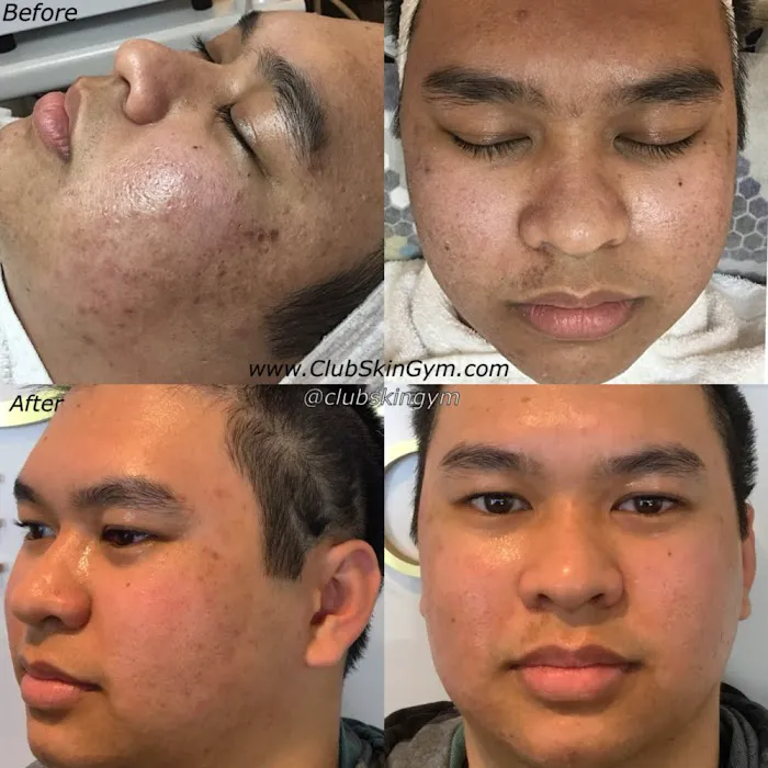 Club Skin Gym Inc Picture 8