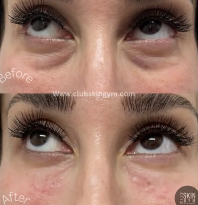 Club Skin Gym Inc Picture 6