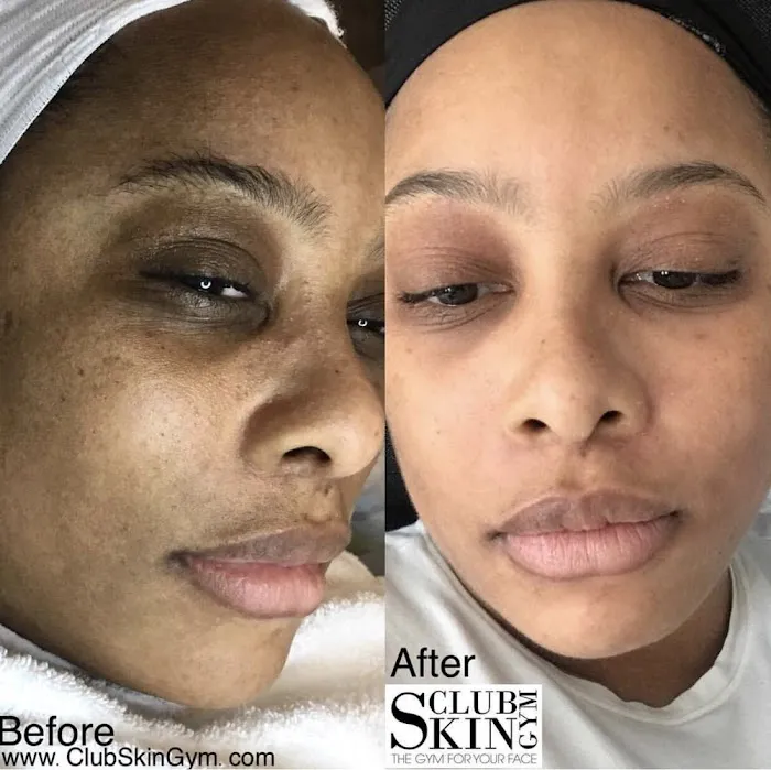 Club Skin Gym Inc Picture 2