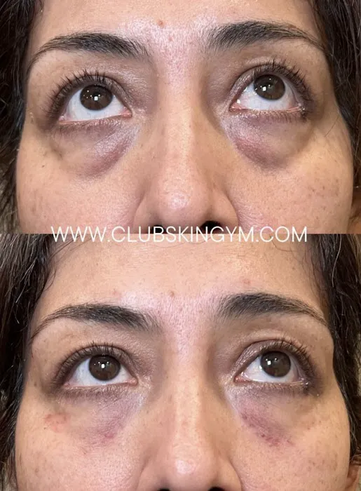 Club Skin Gym Inc Picture 9