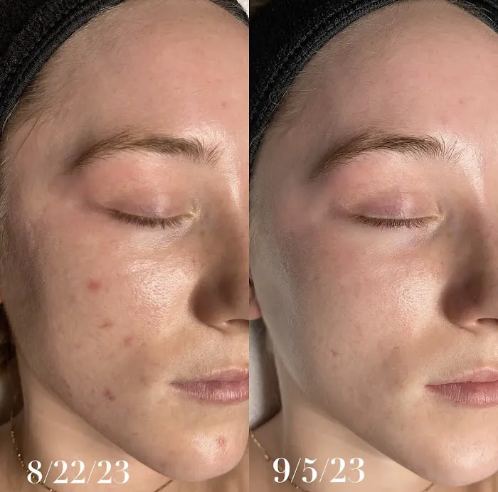 Bare Beauty OC Picture 6