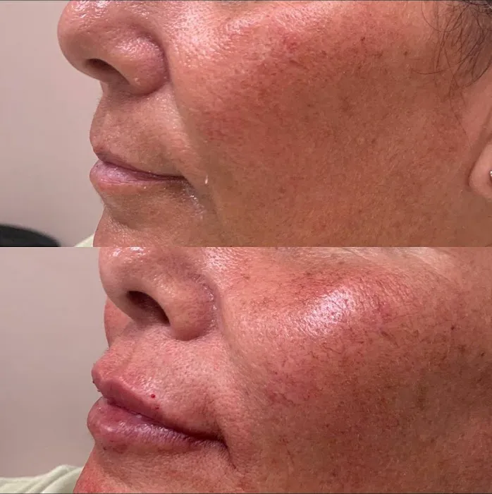 SPEAKEASY AESTHETICS Picture 5