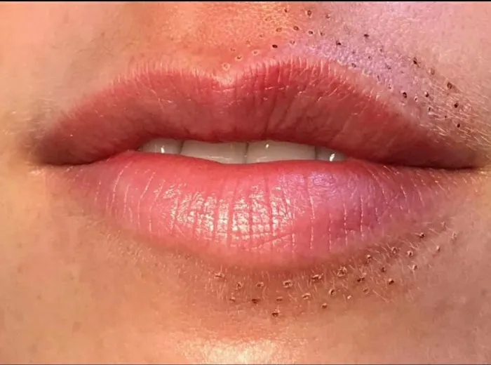 SPEAKEASY AESTHETICS Picture 2