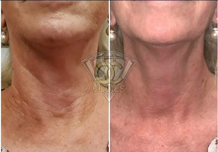 SPEAKEASY AESTHETICS Picture 8