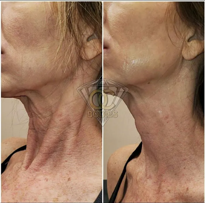 SPEAKEASY AESTHETICS Picture 7