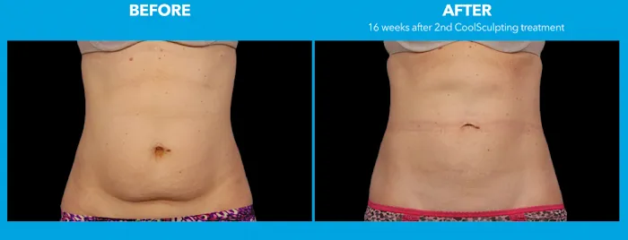 Sublime MD Picture 1