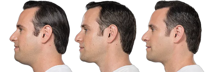 Sublime MD Picture 4