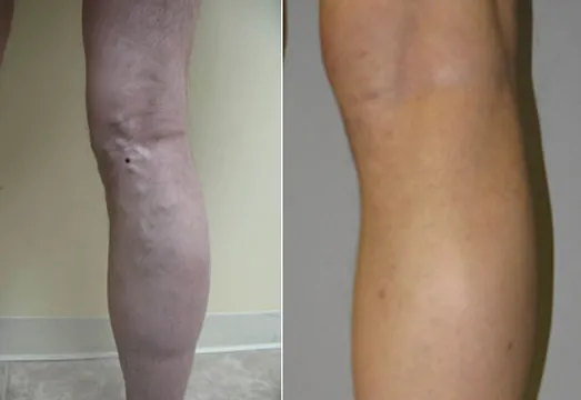 VSA - Vein Specialists of California Picture 1