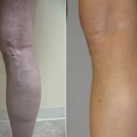 VSA - Vein Specialists of California ico