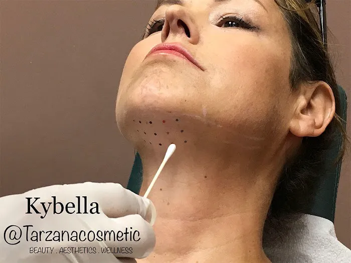 Tarzana Cosmetic Wellness & Medspa Picture 5