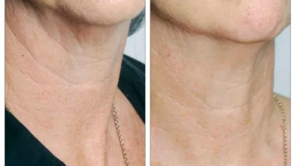 Sinai Signature (Appointments Only) Picture 3