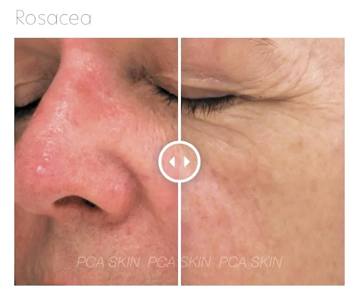 Empowered Esthetic Picture 8