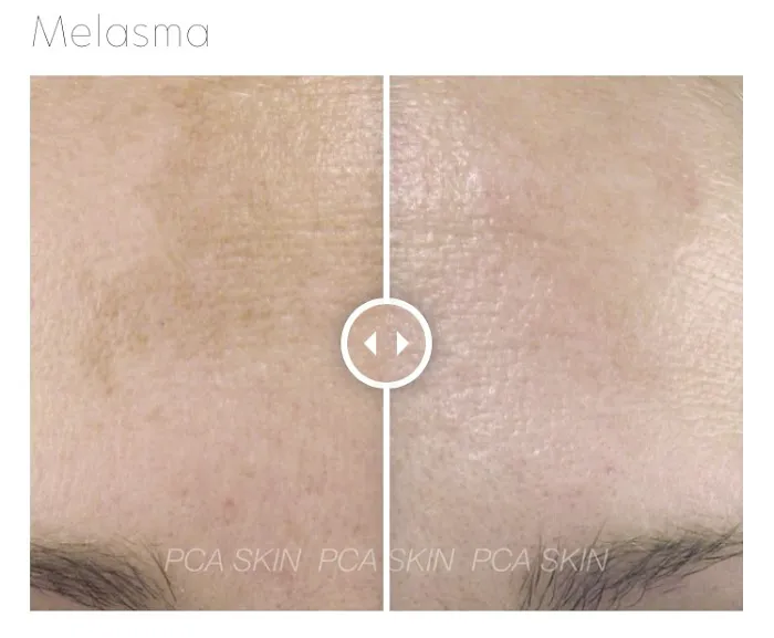 Empowered Esthetic Picture 3