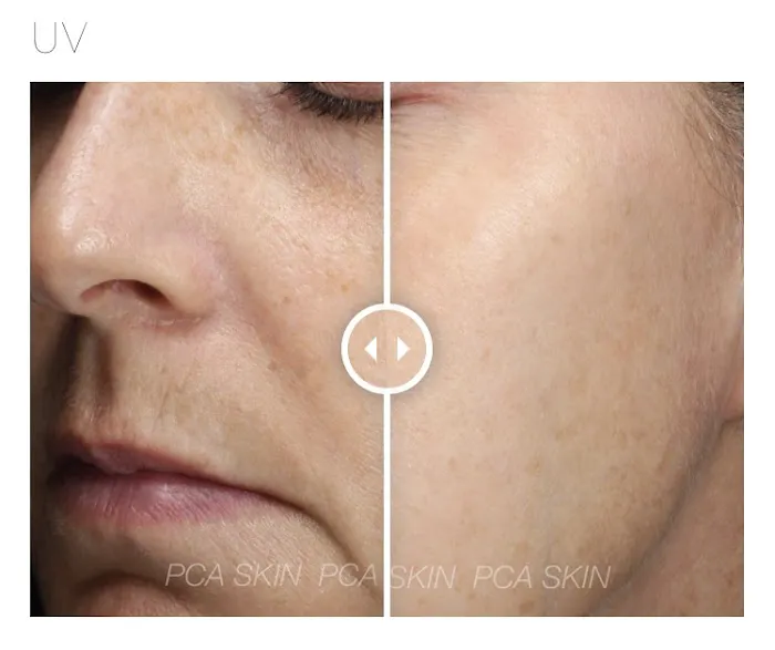 Empowered Esthetic Picture 2