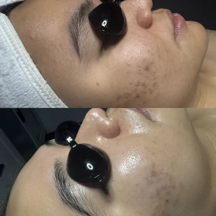 Crown Skin Picture 7