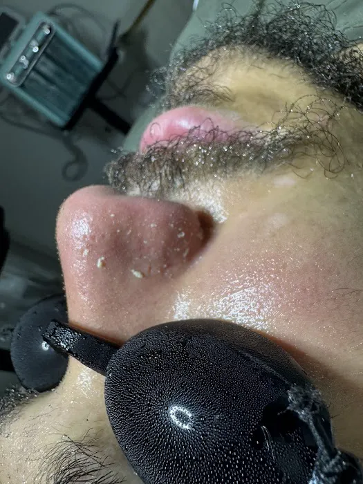 Crown Skin Picture 6