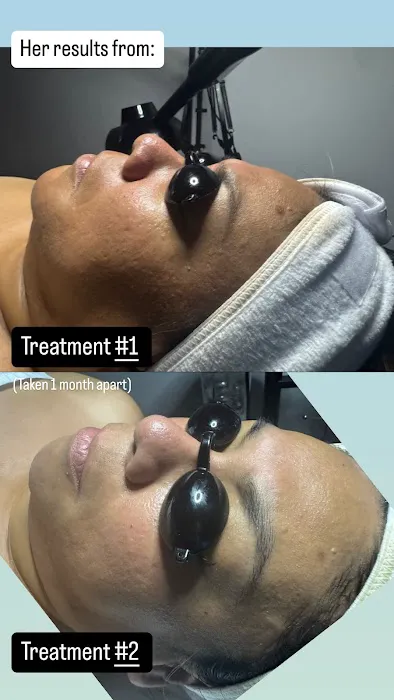 Crown Skin Picture 3