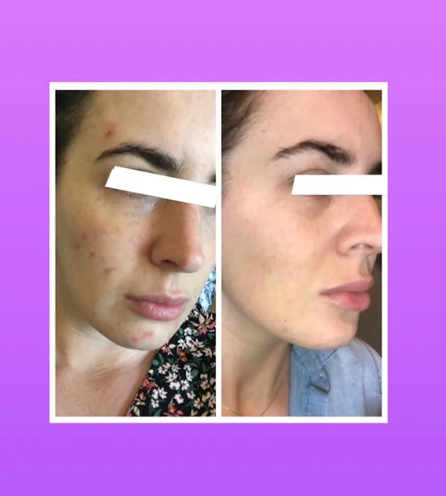 The Sun Elixir Picture 2