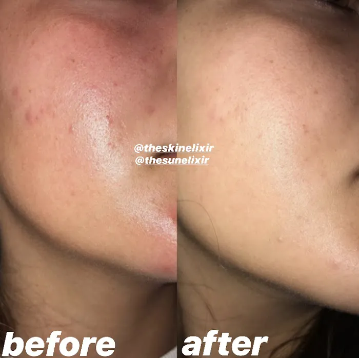 The Sun Elixir Picture 8