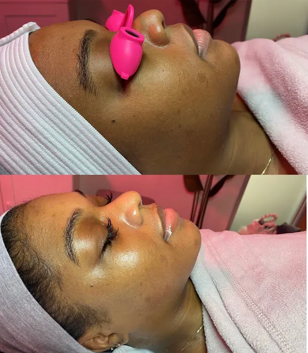 SkinByMyaa Picture 2