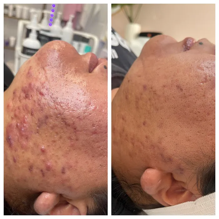 Complexions by Hope skincare studio Picture 5