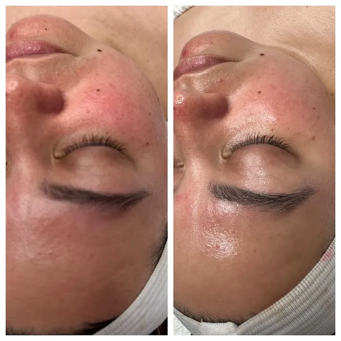 Complexions by Hope skincare studio Picture 3