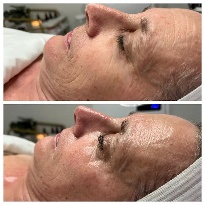 Complexions by Hope skincare studio Picture 8